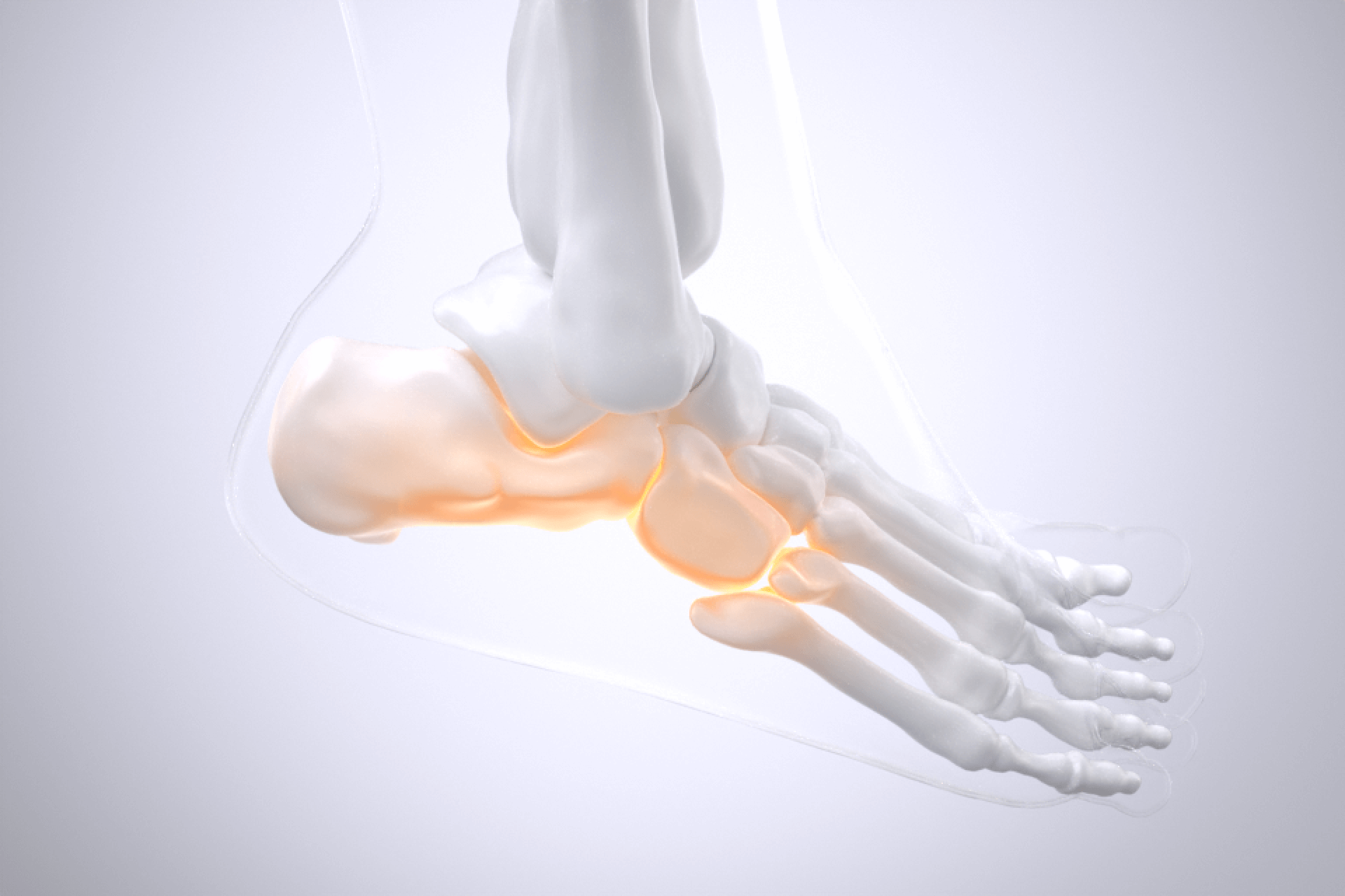 족저근막염 설명 영상