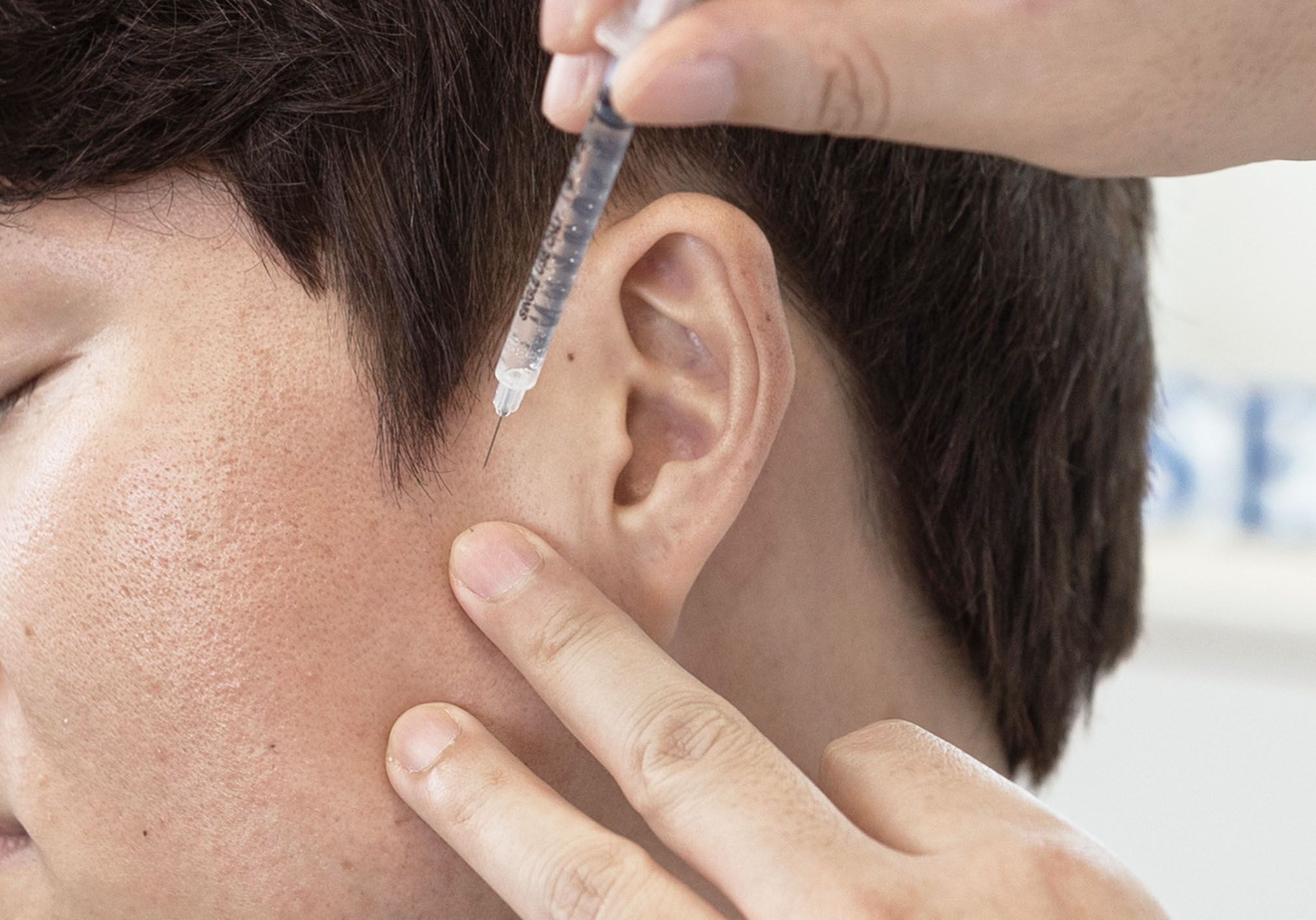 턱 신경근회복술