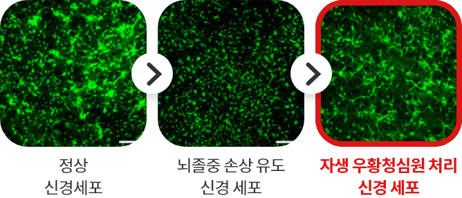 정상 신경세포 - 뇌졸중 손상 유도 신경 세포 - 자생 우황청심원 처리 신경 세포