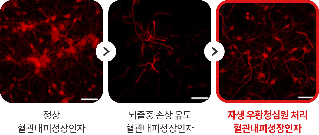 정상 혈관내피성장인자 - 뇌졸중 손상유도 혈관내피성장인자 - 자생 우황청심원 처리 혈관내피성장인자
