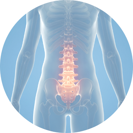 척추불안정 그래픽