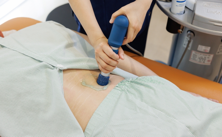 체외충격파 시술